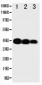 Anti-IL-12(p40) Antibody